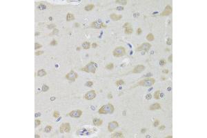 Immunohistochemistry of paraffin-embedded rat brain using DHRS9 Antibody (ABIN1980340) at dilution of 1:100 (40x lens). (DHRS9 anticorps)