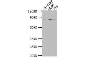 Western Blot Positive WB detected in: SH-SY5Y whole cell lysate, HL60 whole cell lysate, 293 whole cell lysate All lanes: CEACAM5 antibody at 1:2000 Secondary Goat polyclonal to rabbit IgG at 1/50000 dilution Predicted band size: 77 kDa Observed band size: 77 kDa (CEACAM5 anticorps  (AA 1-255))