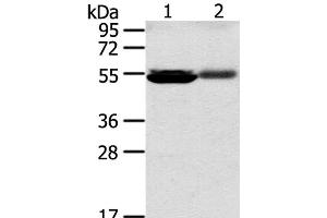 Western Blot analysis of Human kidney pericarcinous and kidney cancer tissue using SLC17A1 Polyclonal Antibody at dilution of 1:200 (SLC17A1 anticorps)