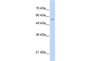 WB Suggested Anti-PGS1 Antibody Titration:  0. (PGS1 anticorps  (C-Term))