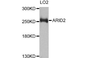 Western blot analysis of extracts of LO2 cells, using ARID2 antibody (ABIN5996429) at 1/1000 dilution.