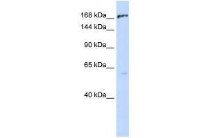 WB Suggested Anti-ABCC1 Antibody Titration:  0. (ABCC1 anticorps  (Middle Region))
