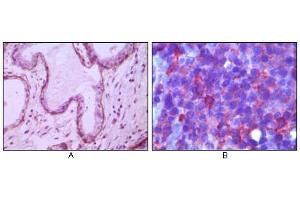 Immunohistochemical analysis of paraffin-embedded human breast ductal myoepithelium (A) and lymph tissue (B), showing cytoplasmic (A) and membrane (B) localization using CD10 mouse mAb with DAB staining (A) and AEC staining (B). (MME anticorps)