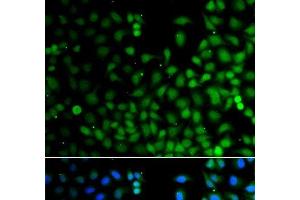 Immunofluorescence analysis of A549 cells using LHX6 Polyclonal Antibody (LHX6 anticorps)
