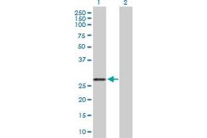 Western Blot analysis of ARHGDIA expression in transfected 293T cell line by ARHGDIA MaxPab polyclonal antibody. (ARHGDIA anticorps  (AA 1-204))