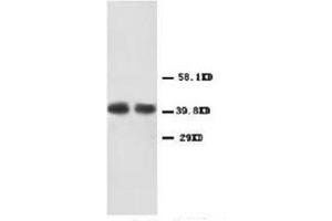 Western blot analysis of human carcinoma of colon lysis using CXCR2 antibody (CXCR2 anticorps  (Middle Region))