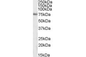 Western Blotting (WB) image for anti-Inositol-Trisphosphate 3-Kinase C (ITPKC) (Internal Region) antibody (ABIN2464190) (ITPKC anticorps  (Internal Region))