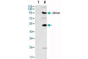 Western blot analysis using CSF1 monoclonal antibody, clone 2D10  against human recombinant CSF2 (1) and CSF1 (2) . (M-CSF/CSF1 anticorps)