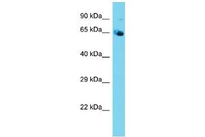 Host: Rabbit  Target Name: Nploc4  Sample Tissue: Mouse Testis lysates  Antibody Dilution: 1. (NPLOC4 anticorps  (N-Term))