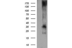 Western Blotting (WB) image for anti-T-cell surface glycoprotein CD1c (CD1C) antibody (ABIN2670658) (CD1c anticorps)