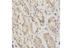 Immunohistochemistry of paraffin-embedded human stomach using STK11 antibody.