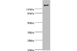 Western blot All lanes: ROCK2 antibody at 2 μg/mL + Rat brain tissue Secondary Goat polyclonal to rabbit IgG at 1/10000 dilution Predicted band size: 161 kDa Observed band size: 161 kDa (ROCK2 anticorps  (AA 1109-1388))
