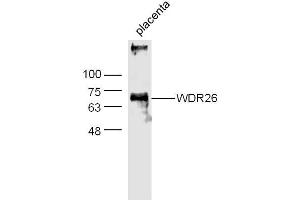 Mouse Placenta lysates probed with WDR26 Polyclonal Antibody, Unconjugated  at 1:300 dilution and 4˚C overnight incubation. (WDR26 anticorps  (AA 101-200))