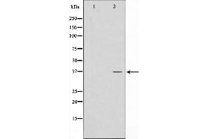 Western blot analysis on LOVO cell lysate using ATPBD3 Antibody，The lane on the left is treated with the antigen-specific peptide. (ATPBD3 anticorps  (C-Term))