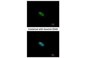 ICC/IF Image Immunofluorescence analysis of paraformaldehyde-fixed HeLa, using ZNF148, antibody at 1:500 dilution.