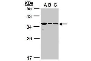 WB Image Sample(30 ug whole cell lysate) A:293T B:A431, C:H1299 12% SDS PAGE antibody diluted at 1:1000
