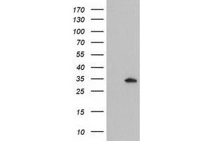 Western Blotting (WB) image for anti-Glutathione S-Transferase omega 2 (GSTO2) antibody (ABIN1498549)