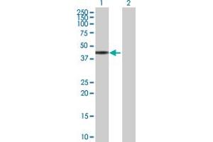 Western Blot analysis of ZNF331 expression in transfected 293T cell line by ZNF331 MaxPab polyclonal antibody. (ZNF331 anticorps  (AA 1-463))