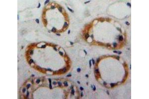 Used in DAB staining on fromalin fixed paraffin-embedded Kidney tissue