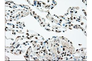 Image no. 2 for anti-Mitogen-Activated Protein Kinase Kinase 4 (MAP2K4) antibody (ABIN1499482)