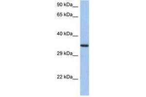 Image no. 1 for anti-HORMA Domain Containing 2 (HORMAD2) (AA 35-84) antibody (ABIN6743695) (HORMAD2 anticorps  (AA 35-84))