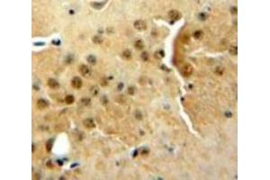 Used in DAB staining on fromalin fixed paraffin-embedded Brain tissue (DGKZ anticorps  (AA 695-932))