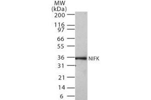 Western Blotting (WB) image for anti-MKI67 FHA Domain-Interacting Nucleolar Phosphoprotein (MKI67IP) (AA 100-200) antibody (ABIN208012) (NIFK anticorps  (AA 100-200))