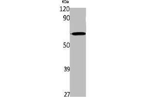Western Blot analysis of K562 cells using IL-28Rα Polyclonal Antibody (IL28RA anticorps  (Internal Region))