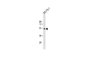 Anti-BRP16 Antibody (Center) at 1:1000 dilution + ZR-75-1 whole cell lysate Lysates/proteins at 20 μg per lane.