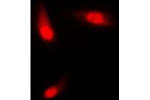 Immunofluorescent analysis of Cytokeratin 8 staining in NIH3T3 cells.