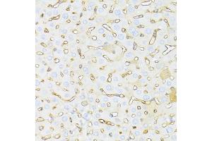 Immunohistochemistry of paraffin-embedded mouse liver using HAVCR2 antibody. (TIM3 anticorps)