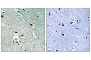 Immunohistochemistry analysis of paraffin-embedded human brain tissue using c-Met (Ab-1003) antiobdy.