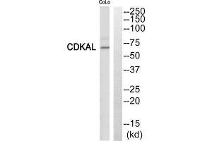 Western Blotting (WB) image for anti-CDK5 Regulatory Subunit Associated Protein 1-Like 1 (CDKAL1) (N-Term) antibody (ABIN1850262) (CDKAL1 anticorps  (N-Term))