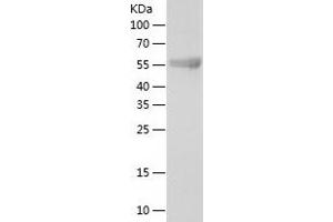 Western Blotting (WB) image for Kelch-Like 12 (Drosophila) (KLHL12) (AA 1-568) protein (His tag) (ABIN7123668)