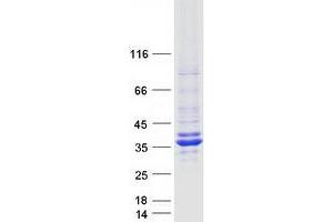 Validation with Western Blot