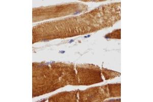 Immunohistochemical analysis of TITIN in Human skeletal muscle tissue sections(IHC-P - paraformaldehyde-fixed, paraffin-embedded sections).