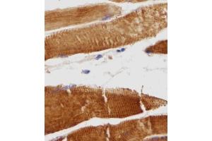Immunohistochemical analysis of TITIN in Human skeletal muscle tissue sections(IHC-P - paraformaldehyde-fixed, paraffin-embedded sections). (Titin anticorps  (N-Term))
