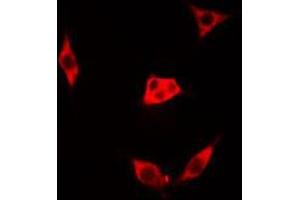 ABIN6273514 staining Hela cells by IF/ICC. (LGALS1/Galectin 1 anticorps  (Internal Region))