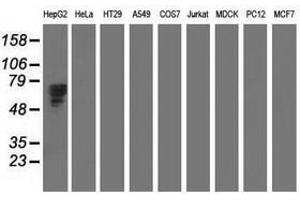 Image no. 2 for anti-alpha-Fetoprotein (AFP) antibody (ABIN1496490) (alpha Fetoprotein anticorps)