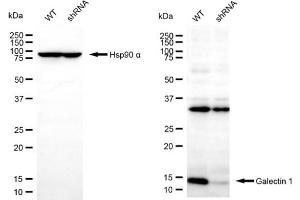 Western blotting analysis using galectin 1 antibody (ABIN7799241). (LGALS1/Galectin 1 anticorps)