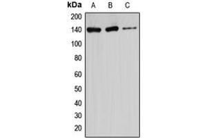 Western blot analysis of Ataxin 2 expression in HeLa (A), U87MG (B), Jurkat (C) whole cell lysates.
