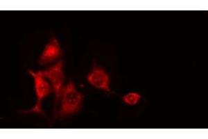 ABIN6275205 staining RAW264. (CEP97 anticorps  (Internal Region))