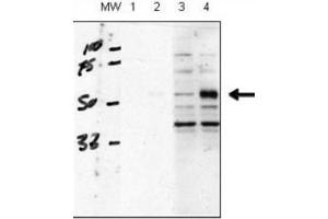 Western Blotting (WB) image for anti-Activin A Receptor Type II-Like 1 (ACVRL1) antibody (ABIN3003504)