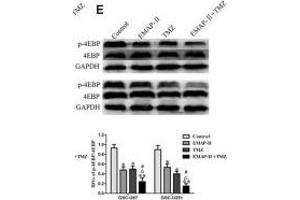 EMAP-II in combination with TMZ induced GSCs autophagy through MACC1 inhibiting PI3K/AKT/mTOR signaling pathway. (eIF4EBP1 anticorps  (C-Term))