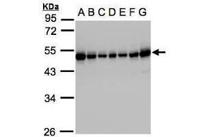 WB Image Sample(30μg whole cell lysate) A: 293T B: A431 , C: H1299 D: HeLa S3 , E: Hep G2 , F: MOLT4 , G: Raji , 10% SDS PAGE antibody diluted at 1:1000