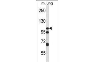 CTNND2 Antibody (C-term) (ABIN656479 and ABIN2845759) western blot analysis in mouse lung tissue lysates (35 μg/lane).