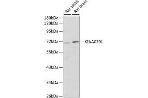 Western blot analysis of extracts of various cell lines, using KI antibody (ABIN6133342, ABIN6142843, ABIN6142845 and ABIN6220233) at 1:1000 dilution. (KIAA0391 anticorps  (AA 314-583))