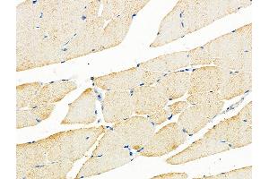 ABIN6259513 and ABIN6275914 at 1/100 staining Mouse muscle tissue by IHC-P. (Adenosine A3 Receptor anticorps  (C-Term))