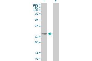 Western Blot analysis of LIN28 expression in transfected 293T cell line by LIN28 MaxPab polyclonal antibody. (LIN28A anticorps  (AA 1-209))