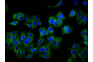 Immunofluorescence staining of HepG2 cells with ABIN7175220 at 1:100, counter-stained with DAPI.